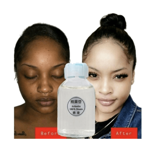 Dark Skin Super Whitening Serum Arbutin Cream